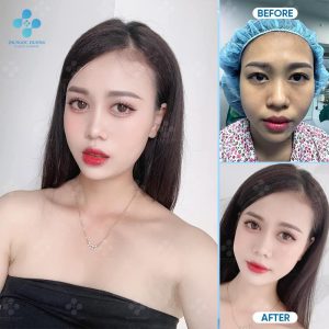 Hình ảnh khách hàng sau khi cắt
