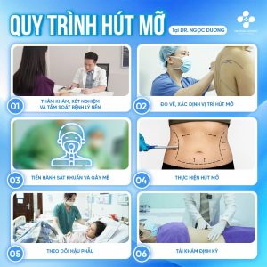 Quy trình hút mỡ tại Dr.Ngọc Dương