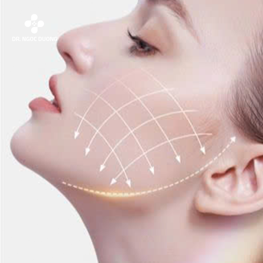 Cân chỉnh cằm mặt Vline tự nhiên